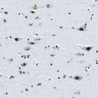 Immunohistochemical staining of human cerebral cortex shows strong nuclear positivity in neurons.
