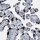 Immunohistochemical staining of human placenta shows very strong nuclear positivity in trophoblastic cells.