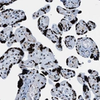 Immunohistochemical staining of human placenta shows very strong nuclear positivity in trophoblastic cells.
