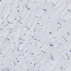Immunohistochemical staining of human skeletal muscle shows no positivity in myocytes as expected.