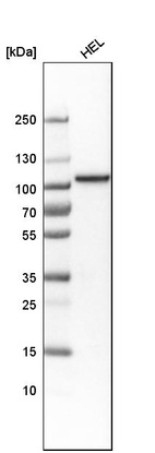 Western blot analysis in human cell line HEL.