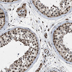 Immunohistochemical staining of human testis shows strong nuclear positivity in cells in seminiferous ducts.