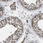 Immunohistochemical staining of human testis shows strong nuclear positivity in cells in seminiferous ducts.