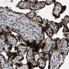 Immunohistochemical staining of human placenta shows strong positivity in trophoblastic cells.