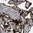 Immunohistochemical staining of human placenta shows strong positivity in trophoblastic cells.