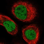 Immunofluorescent staining of human cell line A-431 shows localization to nucleoplasm.