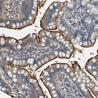Anti-CFLAR Antibody