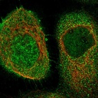 Immunofluorescent staining of human cell line A-431 shows localization to nucleus, plasma membrane & cytosol.