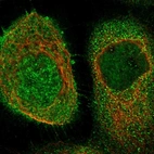 Immunofluorescent staining of human cell line A-431 shows localization to nucleus, plasma membrane & cytosol.