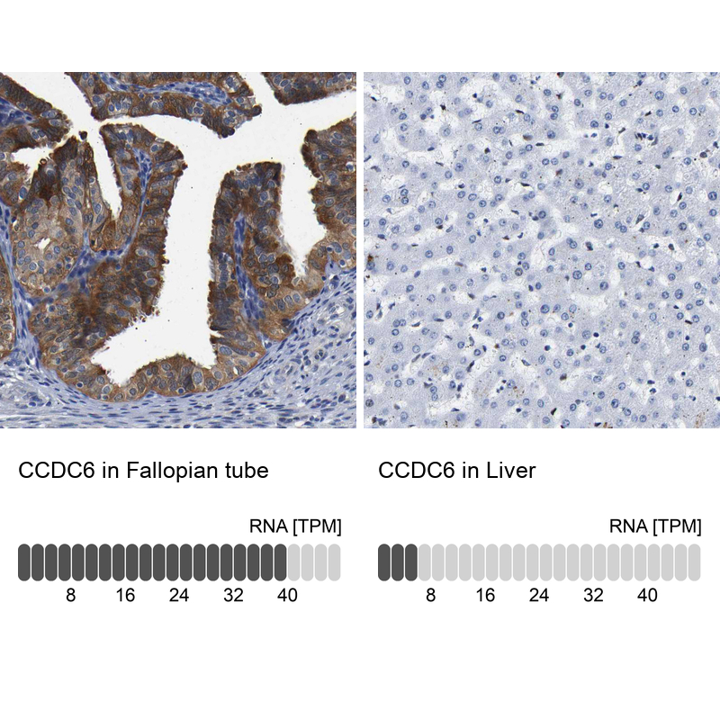 Anti-CCDC6 Antibody