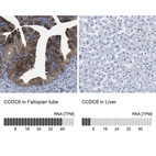 Anti-CCDC6 Antibody