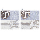 Immunohistochemical staining of human fallopian tube, liver, skin and testis using Anti-CCDC6 antibody HPA019049 (A) shows similar protein distribution across tissues to independent antibody HPA019051 (B).