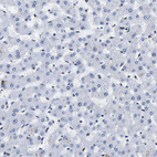 Immunohistochemical staining of human liver shows no positivity in hepatocytes as expected.