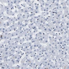 Immunohistochemical staining of human liver shows no positivity in hepatocytes as expected.