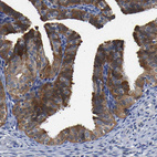 Immunohistochemical staining of human Fallopian tube shows strong cytoplasmic positivity in glandular cells.