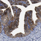 Immunohistochemical staining of human Fallopian tube shows strong cytoplasmic positivity in glandular cells.