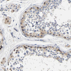Immunohistochemical staining of human testis shows weak to moderate cytoplasmic positivity in cells in seminiferous ducts.