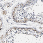 Immunohistochemical staining of human testis shows weak to moderate cytoplasmic positivity in cells in seminiferous ducts.