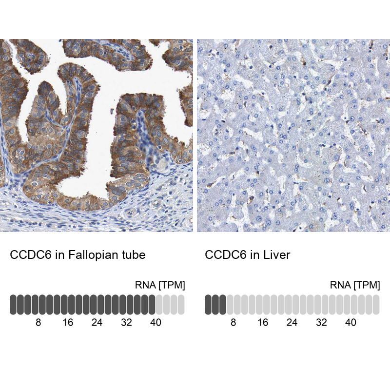 Anti-CCDC6 Antibody