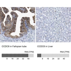 Anti-CCDC6 Antibody