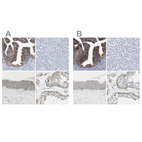 Immunohistochemical staining of human fallopian tube, liver, skin and testis using Anti-CCDC6 antibody HPA019051 (A) shows similar protein distribution across tissues to independent antibody HPA019049 (B).