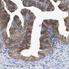 Immunohistochemical staining of human Fallopian tube shows strong cytoplasmic positivity in glandular cells.
