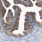 Immunohistochemical staining of human Fallopian tube shows strong cytoplasmic positivity in glandular cells.