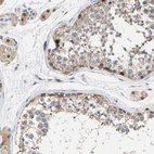 Immunohistochemical staining of human testis shows weak to moderate cytoplasmic positivity in cells in seminiferous ducts.