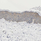 Immunohistochemical staining of human skin shows weak cytoplasmic positivity in squamous epithelial cells.
