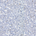 Immunohistochemical staining of human liver shows no positivity in hepatocytes as expected.