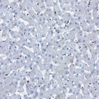 Immunohistochemical staining of human liver shows no positivity in hepatocytes as expected.