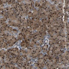 Anti-CROT Antibody