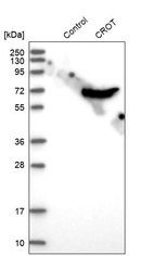 Western blot analysis in control (vector only transfected HEK293T lysate) and CROT over-expression lysate (Co-expressed with a C-terminal myc-DDK tag (~3.1 kDa) in mammalian HEK293T cells, LY412059).