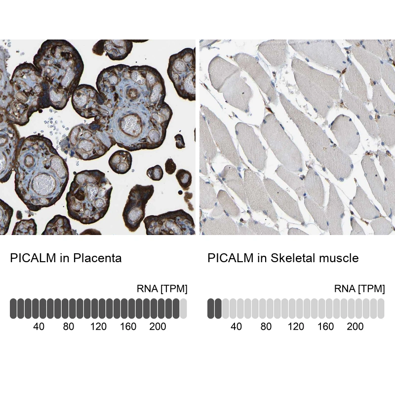 Rabbit Polyclonal Anti-PICALM Antibody - Buy for research - Highly ...