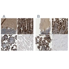Immunohistochemical staining of human cerebellum, duodenum, placenta and skeletal muscle using Anti-PICALM antibody HPA019053 (A) shows similar protein distribution across tissues to independent antibody HPA019061 (B).
