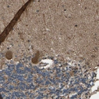 Immunohistochemical staining of human cerebellum shows moderate cytoplasmic positivity in Purkinje cells.