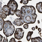 Immunohistochemical staining of human placenta shows strong membranous and cytoplasmic positivity in trophoblastic cells.