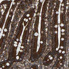 Immunohistochemical staining of human duodenum shows strong membranous and cytoplasmic positivity in glandular cells.