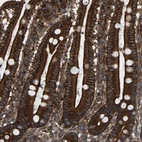 Immunohistochemical staining of human duodenum shows strong membranous and cytoplasmic positivity in glandular cells.