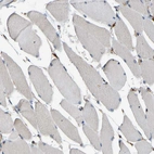 Immunohistochemical staining of human skeletal muscle shows no positivity in myocytes as expected.