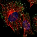 Immunofluorescent staining of human cell line U-251 MG shows localization to vesicles.