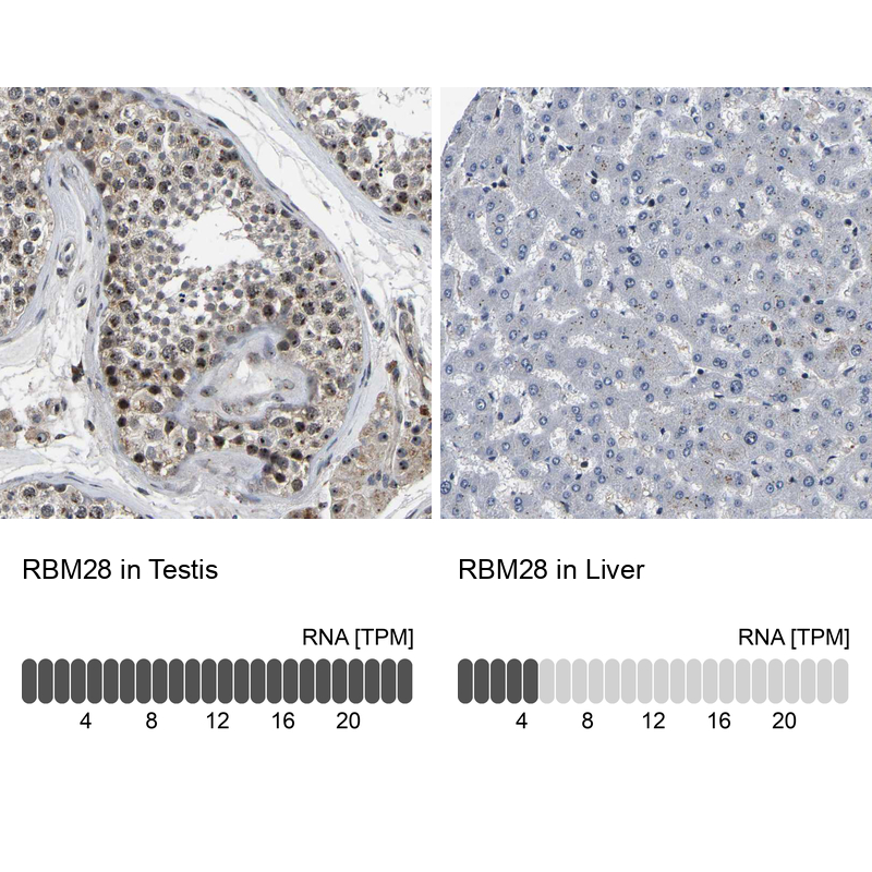 Anti-RBM28 Antibody