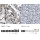 Anti-RBM28 Antibody