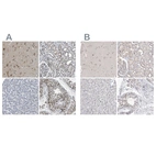 Immunohistochemical staining of human cerebral cortex, kidney, liver and testis using Anti-RBM28 antibody HPA019058 (A) shows similar protein distribution across tissues to independent antibody HPA026672 (B).
