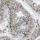 Immunohistochemical staining of human testis shows strong positivity in nucleoli in cells in seminiferous ducts.