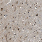 Immunohistochemical staining of human cerebral cortex shows strong positivity in nucleoli in neurons.