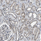 Immunohistochemical staining of human kidney shows strong positivity in nucleoli in cells in tubules.