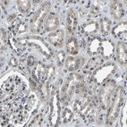 Immunohistochemical staining of human kidney shows strong positivity in nucleoli in cells in tubules.