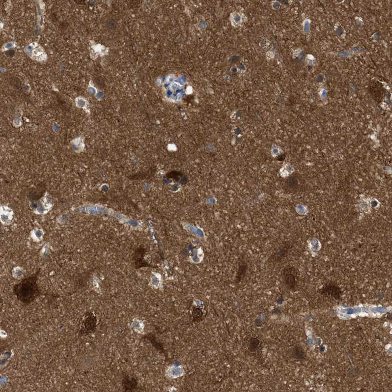 Anti-RAP1GDS1 Antibody