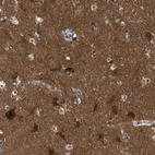Anti-RAP1GDS1 Antibody